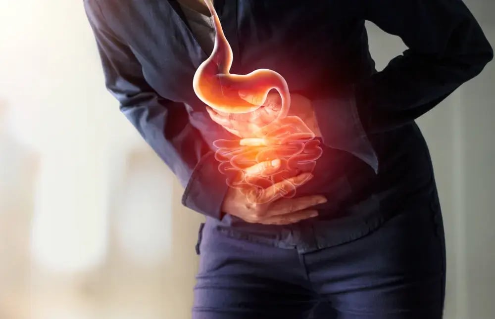 hernia-hiatal-y-reflujo-erge